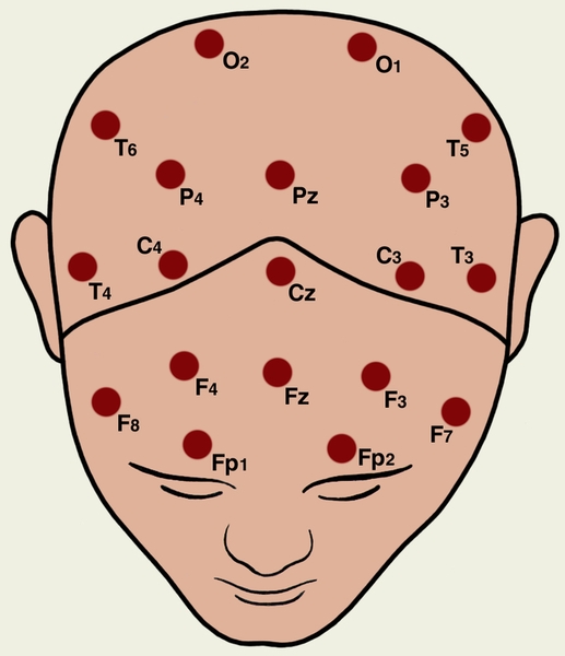 Electrode positions